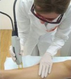 Depilação a laser