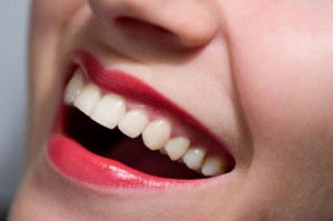 Clareamento Dental – Preço