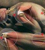 Dores nas articulaçoes e musculos