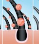 botox-capilar-como-funciona