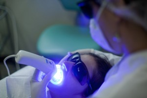 Foto de Clareamento  Dental a Laser